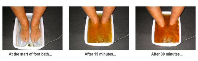What are some benefits of ionic foot baths?